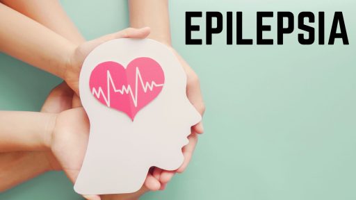 ¿Cuál es la causa de la epilepsia?